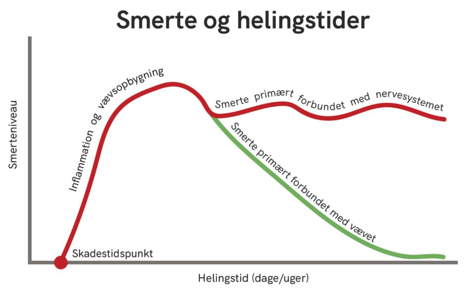 Illustration af smerter over tid