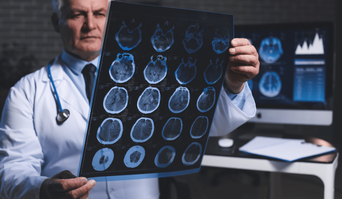 Illustration af fund på en MR-scanning