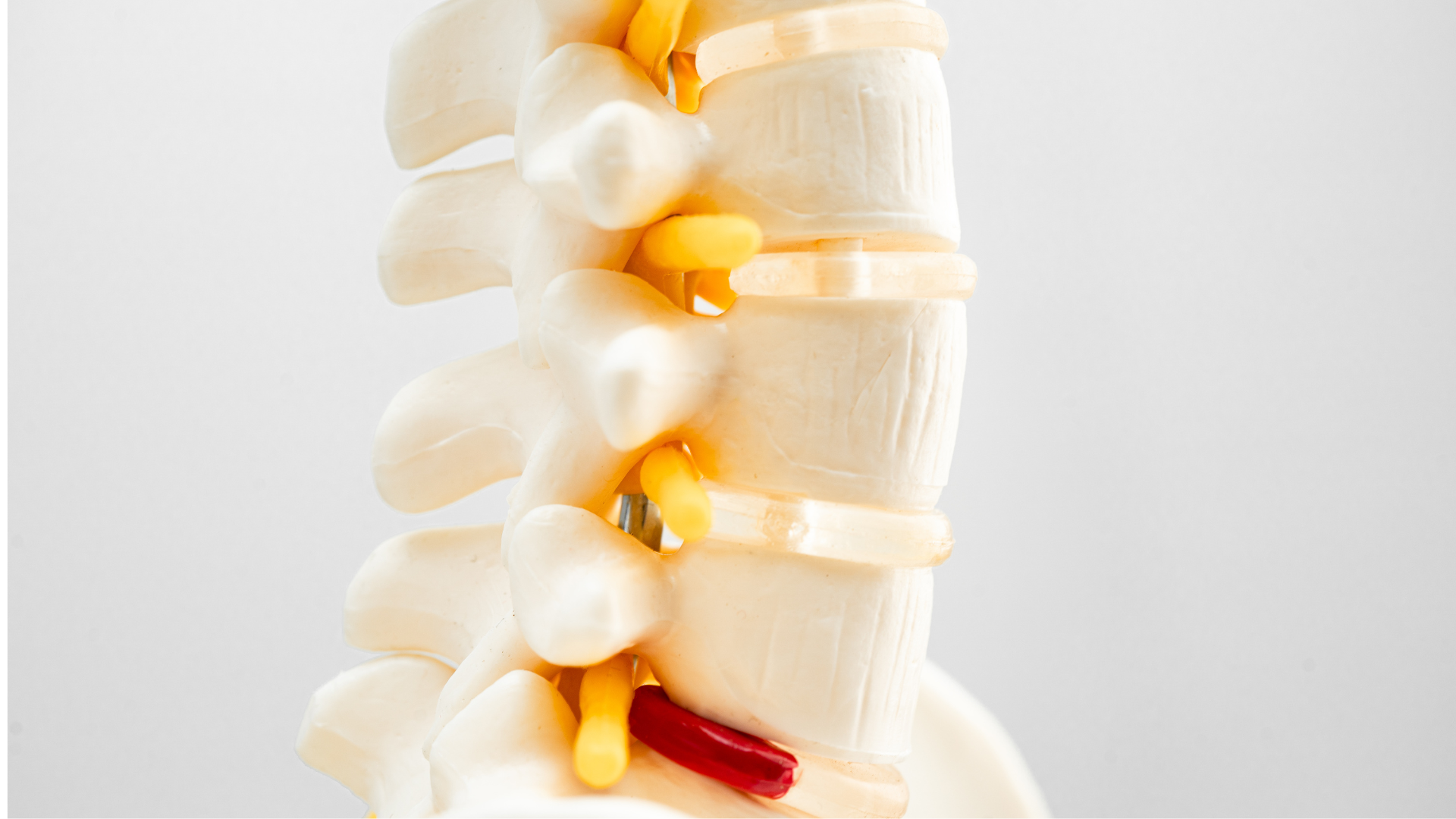 Illustration af anatomien bag spinalstenose
